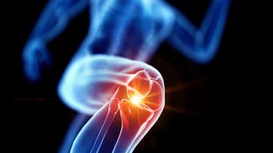 Runner with knee pain, conceptual illustration