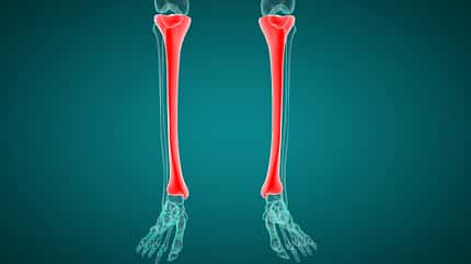 Tibia Schienbein Schienbeinkantensyndrom Schmerzen und Empfindlichkeit entlang des Schienbeins (Tibia) während des Laufens deuten auf ein Schienbeinkantensyndrom (Shin Splints) hin.