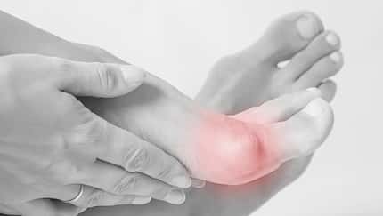 Fußfehlstellung: Hallux Rigidus