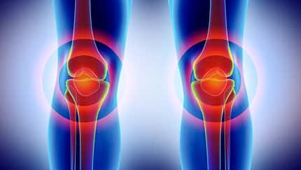 Knee painful - skeleton x-ray.