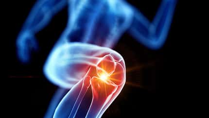 Runner with knee pain, conceptual illustration