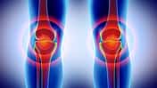 Knee painful - skeleton x-ray.