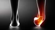 Sprained ankle black x-ray