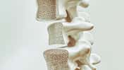 Osteoporosis on the spine - 3d rendering